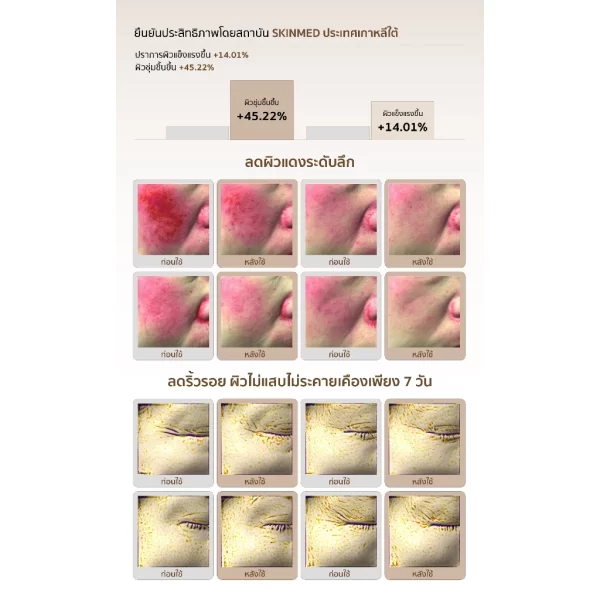 INTENSIVE CALMAGE OINTMENT