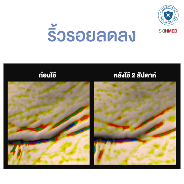 ExoNAD+ FIRMIING MASK 5 แผ่น